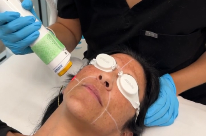 Laser Laser Treatments in Charleston County, SC