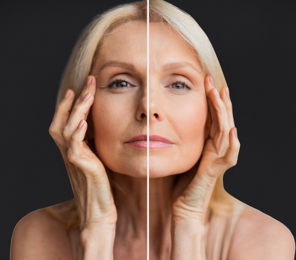 Skin Resurfacing 1 Laser Skin Resurfacing in Charleston County, SC