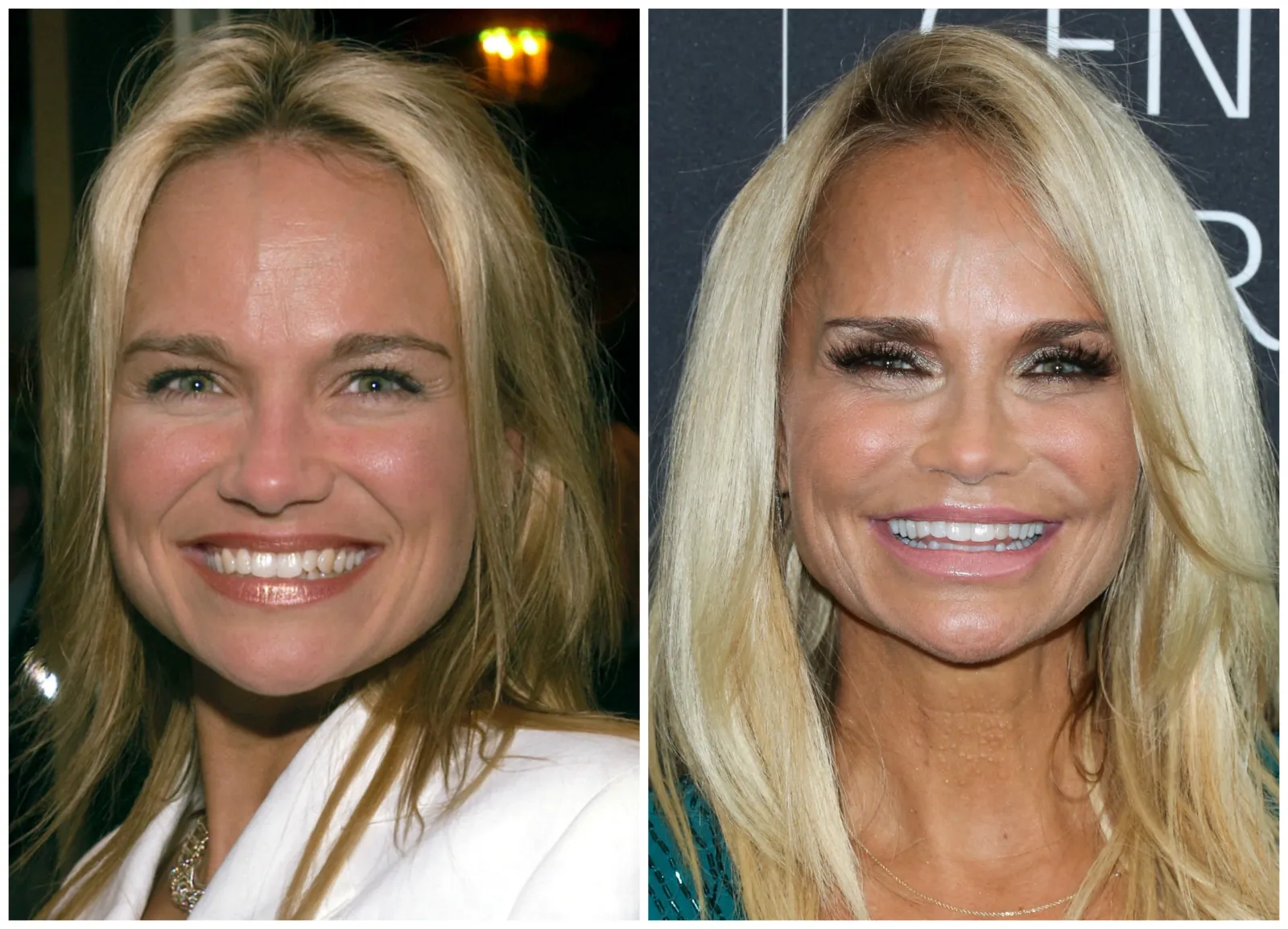 Plastic Surgery (Cosmetic Surgery) in Charleston County, SC