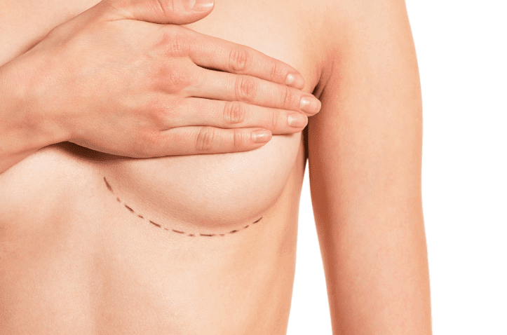 Breast Enhancement in Charleston County, SC