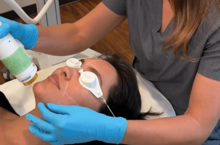 Laser Skin Resurfacing in Charleston County, SC