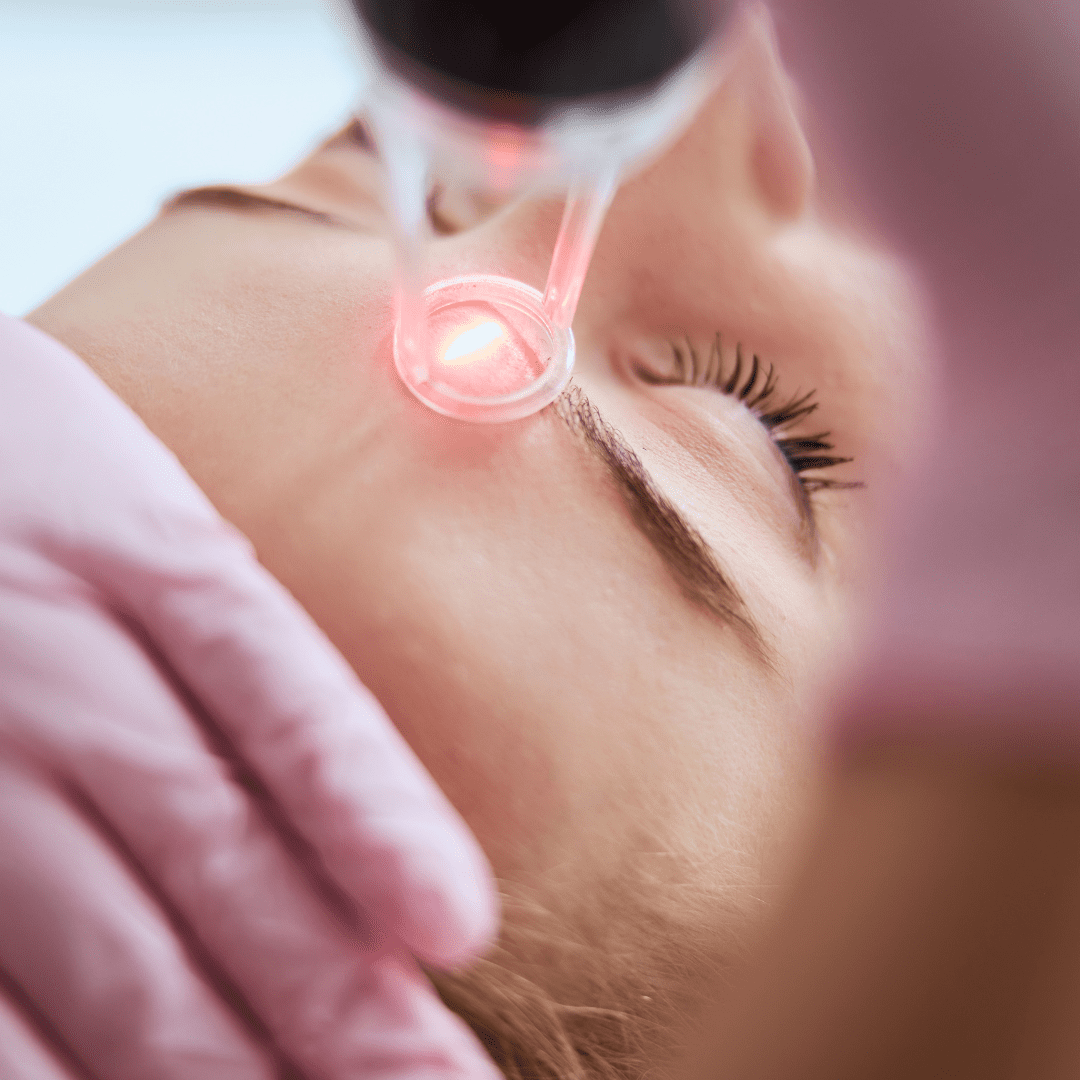 Aerolase Laser in Charleston County, SC